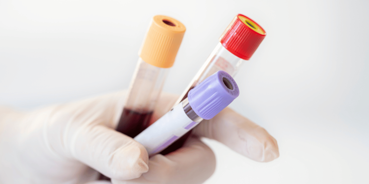 Blood in test tubes