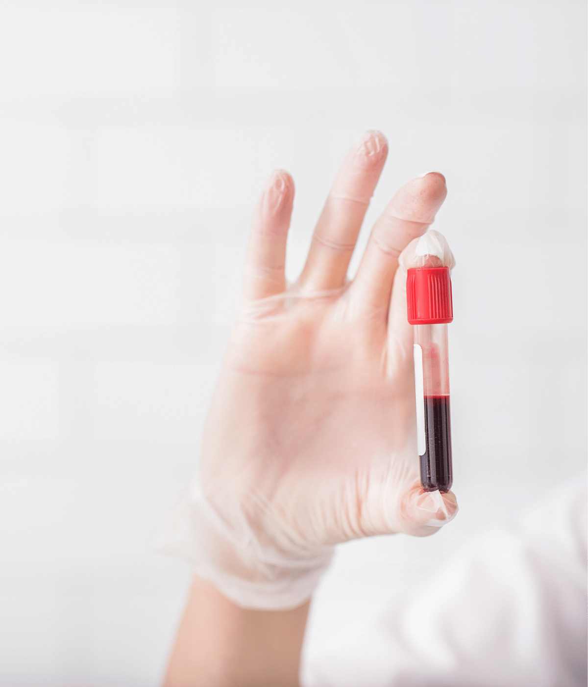 Nurse holding blood vile